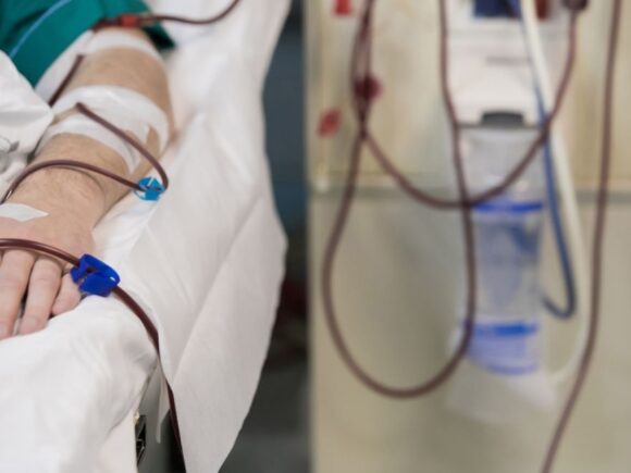 The $30,000 Question: Tackling the Dialysis Crisis in LMICs Through Smart Equipment Management